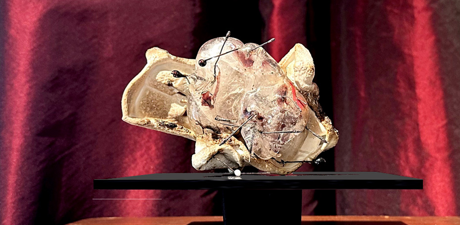 260115 - JZ - Hallway 12